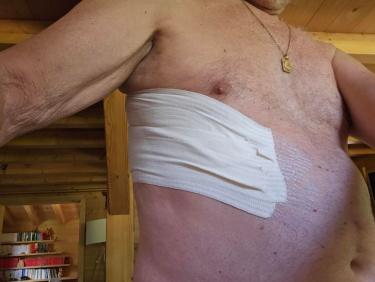 RUN 33: Test du strapping des cotes 🫠